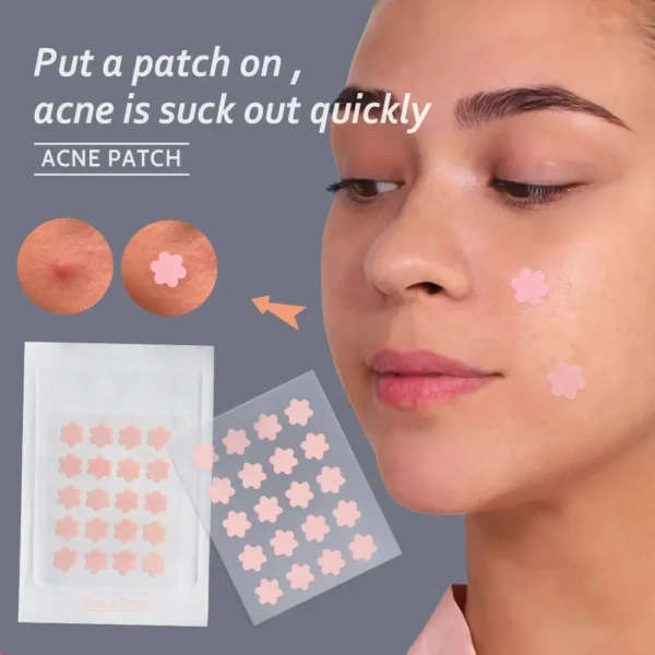 16 Counts Acne Patch (7)