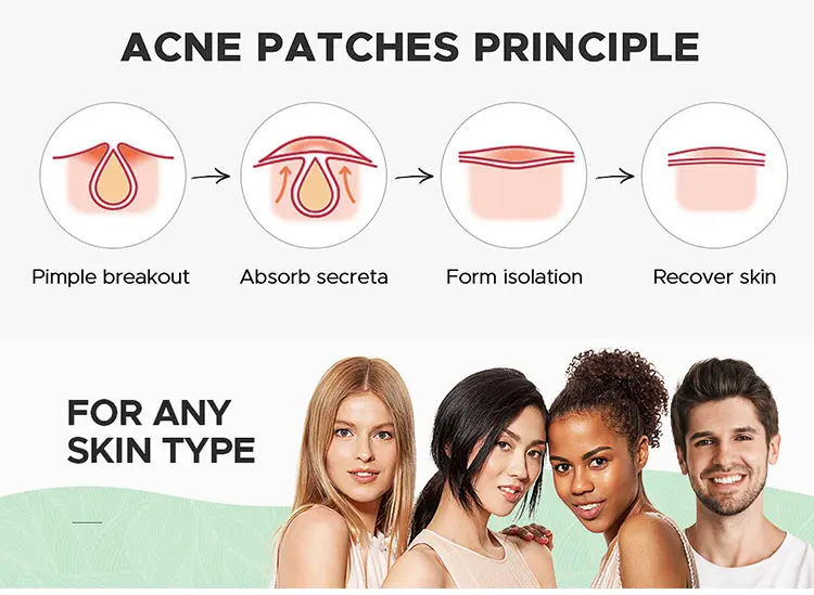 18 Counts Acne Patch (6)