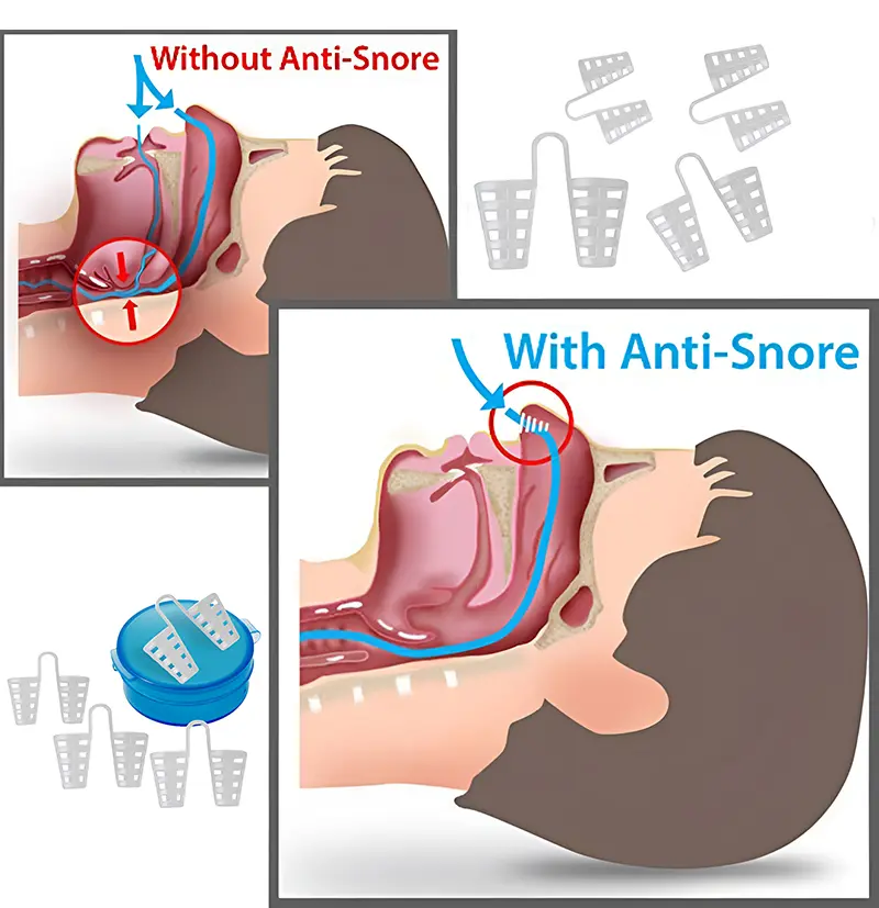 Nose Vent Sinus Relief Dilator (4)