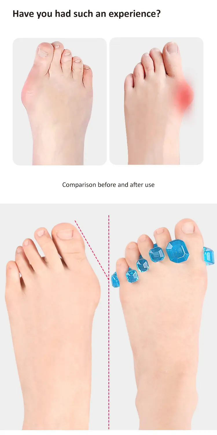 Toe Separator (3)