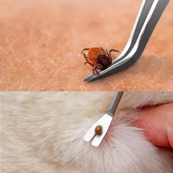 Tick Remover (1)