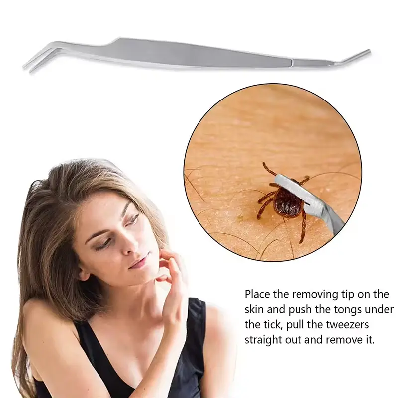 Tick Remover (3)