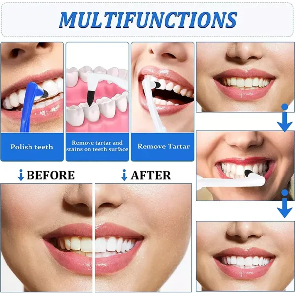 Tartar Remover Tooth Stain Eraser (4)