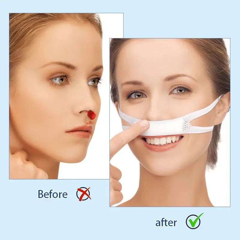 Elastic Nose Bandage (5)