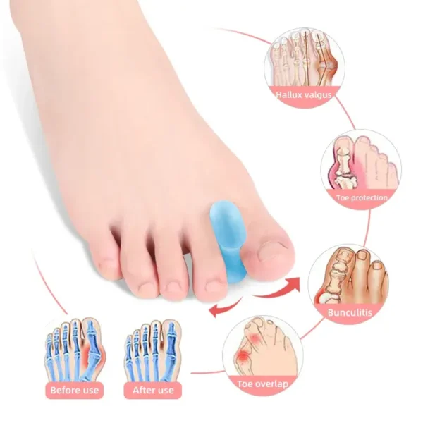 Gel Toe Separators (1)